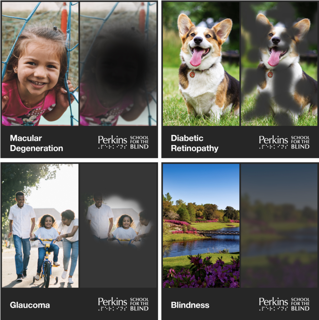 Photo is split into four segments that each depict a different kind of blindness